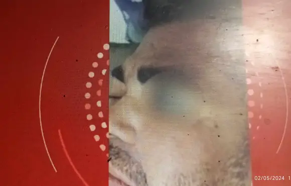 Guardas municipais são suspeitos de agredir homem com pedaço de madeira no sudoeste da Bahia; dupla foi afastada das ruas; assista vídeo